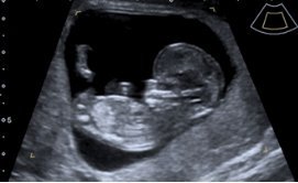 "Just a quick update on my pregnancy!" - Conceive Plus®