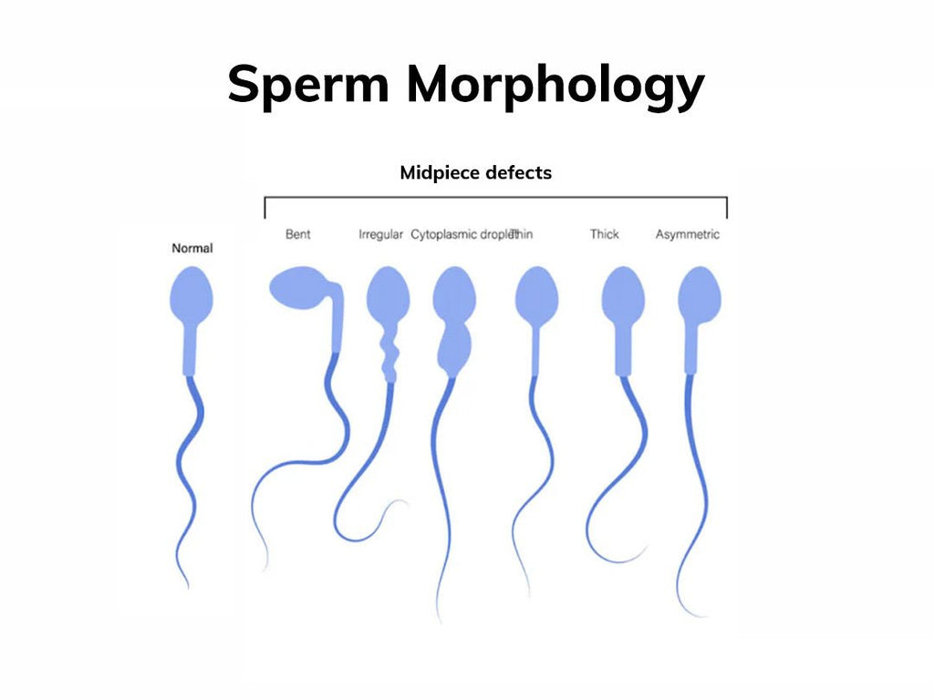 How Sperm in Egg Leads to Fertilization and the Journey of Sperm and Egg Cells - Conceive Plus®
